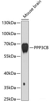 Western blot analysis of extracts of various cell lines using SNAP29 Polyclonal Antibody at dilution of 1:1000.
