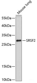 Western blot analysis of extracts of various cell lines using RPH3AL Polyclonal Antibody at dilution of 1:1000.