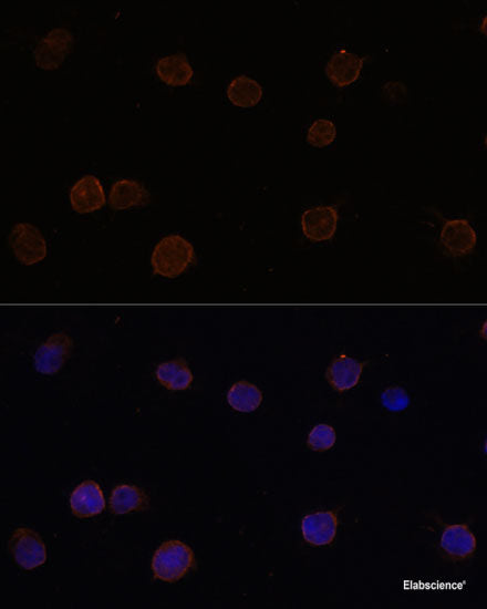 Immunohistochemistry of paraffin-embedded Human prostate using SAFB2 Polyclonal Antibody at dilution of 1:100 (40x lens).