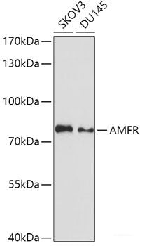 Immunohistochemistry of paraffin-embedded Rat testis using DDX46 Polyclonal Antibody at dilution of 1:100 (40x lens).