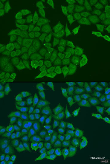 Immunohistochemistry of paraffin-embedded Mouse lung using ABCF2 Polyclonal Antibody at dilution of 1:100 (40x lens).