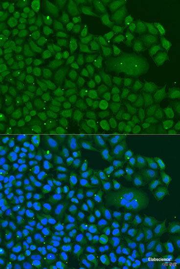 Western blot analysis of extracts of various cell lines using HMG20B Polyclonal Antibody at dilution of 1:1000.