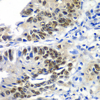 Immunofluorescence analysis of U2OS cells using ADAP1 Polyclonal Antibody at dilution of 1:100. Blue: DAPI for nuclear staining.