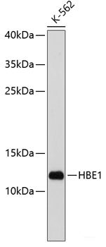 Western blot analysis of extracts of various cell lines using MOB4 Polyclonal Antibody at dilution of 1:3000.