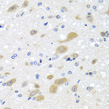 Immunohistochemistry of paraffin-embedded Human esophagus using TMOD3 Polyclonal Antibody at dilution of 1:100 (40x lens).