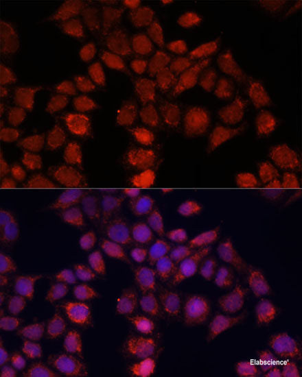 Immunohistochemistry of paraffin-embedded Mouse stomach using UQCR10 Polyclonal Antibody at dilution of 1:100 (40x lens).