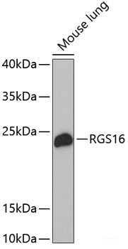 Western blot analysis of extracts of HeLa cells using MFF Polyclonal Antibody.