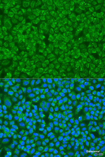 Western blot analysis of extracts of various cell lines using SPTBN1 Polyclonal Antibody at dilution of 1:3000.