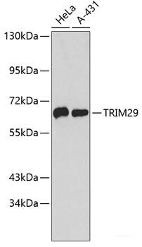 Western blot analysis of extracts of various cell lines using LUM Polyclonal Antibody at dilution of 1:1000.