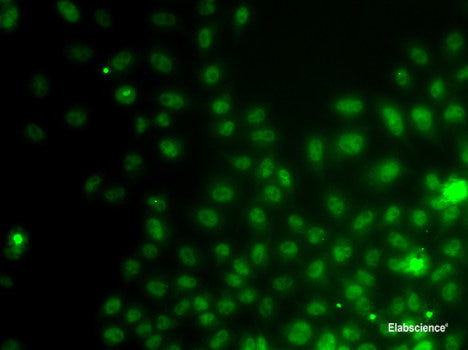 Immunofluorescence analysis of U2OS cells using ASH2L Polyclonal Antibody