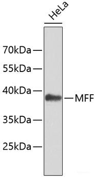Western blot analysis of extracts of various cell lines using FBP1 Polyclonal Antibody at dilution of 1:1000.