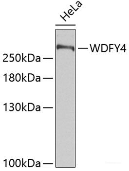 Western blot analysis of extracts of various cell lines using LGI1 Polyclonal Antibody at dilution of 1:3000.