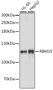 Western blot analysis of extracts of Mouse lung using NPC2 Polyclonal Antibody at dilution of 1:1000.