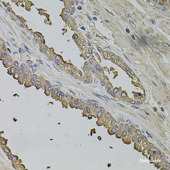 Immunofluorescence analysis of A-549 cells using CBR1 Polyclonal Antibody