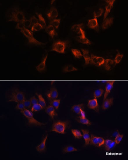 Immunohistochemistry of paraffin-embedded Rat testis using KIF2C Polyclonal Antibody at dilution of 1:100 (40x lens).