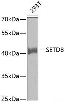 Immunohistochemistry of paraffin-embedded Human thyroid cancer using FHL1 Polyclonal Antibody at dilution of 1:100 (40x lens).