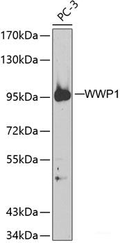 Immunohistochemistry of paraffin-embedded Rat brain using HIF1AN Polyclonal Antibody at dilution of 1:100 (40x lens).