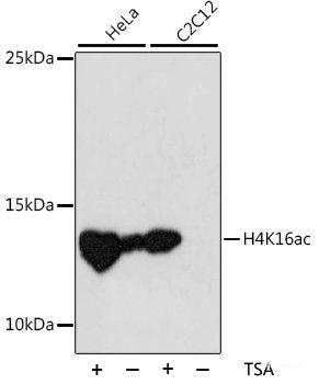 Western blot analysis of extracts of various cell lines using PLA2G1B Polyclonal Antibody at dilution of 1:1000.