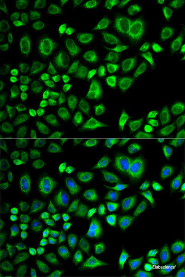 Western blot analysis of extracts of various cell lines using PRPF3 Polyclonal Antibody at dilution of 1:1000.