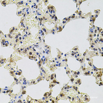 Immunofluorescence analysis of U2OS cells using ALDH3A1 Polyclonal Antibody