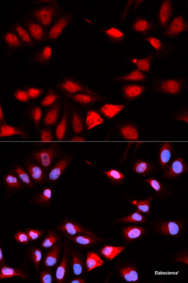 Western blot analysis of extracts of Mouse spleen using CD68 Polyclonal Antibody.