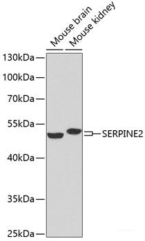 Western blot analysis of extracts of various cell lines using AKT Polyclonal Antibody at dilution of 1:1000.