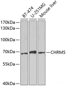 Immunohistochemistry of paraffin-embedded Human liver using STX1A Polyclonal Antibody at dilution of 1:100 (40x lens).