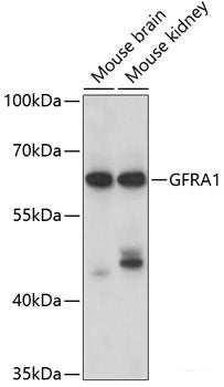 Immunohistochemistry of paraffin-embedded Human breast cancer using SKIV2L2 Polyclonal Antibody at dilution of 1:100 (40x lens).