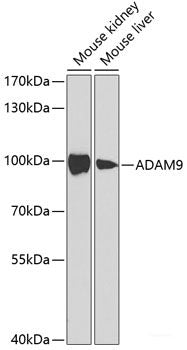 Immunohistochemistry of paraffin-embedded Human stomach using FBXL5 Polyclonal Antibody at dilution of 1:100 (40x lens).