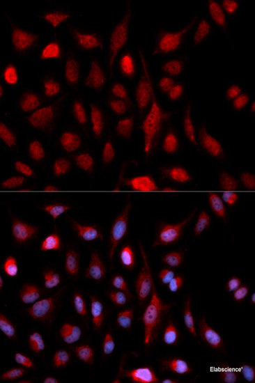 Immunohistochemistry of paraffin-embedded Human colon using FLT4 Polyclonal Antibody at dilution of 1:200 (40x lens).