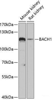 Western blot analysis of extracts of MCF-7 cells using VEGF Receptor 1 Polyclonal Antibody.