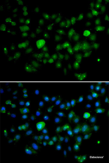 Western blot analysis of extracts of Mouse liver using ECE1 Polyclonal Antibody at dilution of 1:1000.