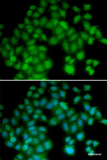 Western blot analysis of extracts of Jurkat cells using FLI1 Polyclonal Antibody at dilution of 1:1000.