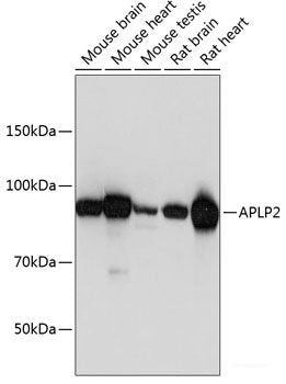 Immunohistochemistry of paraffin-embedded Rat brain using HTR2B Polyclonal Antibody at dilution of 1:100 (40x lens).