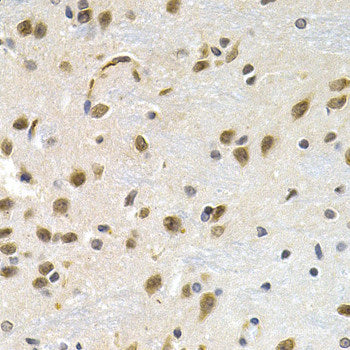 Western blot analysis of extracts of Mouse liver using ITGA2B Polyclonal Antibody at dilution of 1:1000.