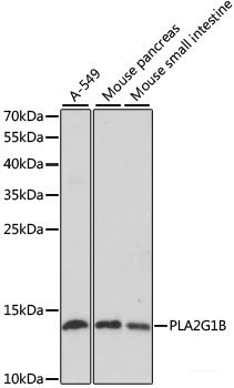 Immunohistochemistry of paraffin-embedded Rat brain using DOK1 Polyclonal Antibody at dilution of 1:100 (40x lens).