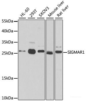 Western blot analysis of extracts of various cell lines using FH Polyclonal Antibody at dilution of 1:1000.