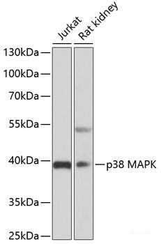 Western blot analysis of extracts of various cell lines using IL1R1 Polyclonal Antibody at dilution of 1:1000.