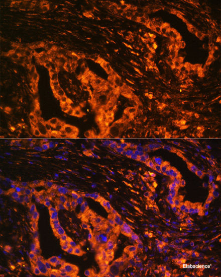 Immunofluorescence analysis of U2OS cells using CDK5 Polyclonal Antibody