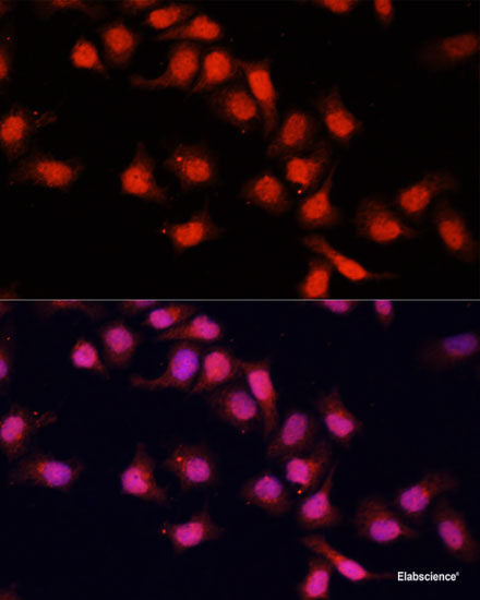 Immunohistochemistry of paraffin-embedded Rat heart using PRPF31 Polyclonal Antibody at dilution of 1:100 (40x lens).