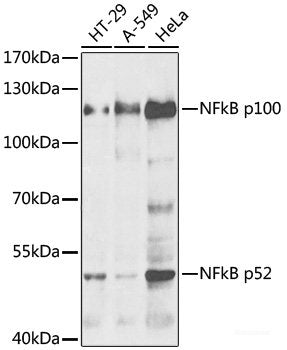 Immunofluorescence analysis of U2OS cells using MAVS Polyclonal Antibody