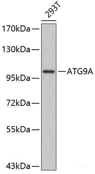 Immunohistochemistry of paraffin-embedded Mouse osteosarcoma using SMARCB1 Polyclonal Antibody at dilution of 1:200 (40x lens).