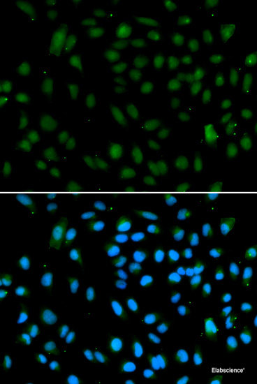 Western blot analysis of extracts of various cell lines using DIAPH1 Polyclonal Antibody at dilution of 1:1000.