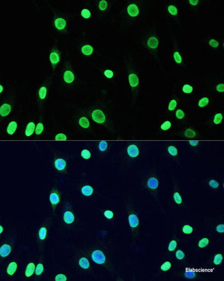 Immunohistochemistry of paraffin-embedded Rat lung using NFKBIB Polyclonal Antibody at dilution of 1:200 (40x lens).