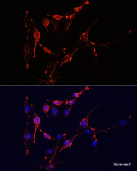 Immunohistochemistry of paraffin-embedded Human liver damage using PEX5 Polyclonal Antibody at dilution of 1:100 (40x lens).