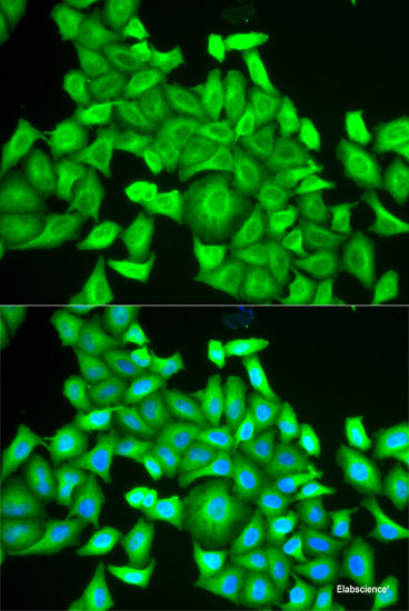 Immunofluorescence analysis of U2OS cells using SEPT2 Polyclonal Antibody