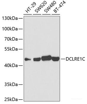 Immunofluorescence analysis of HeLa cells using p53 Polyclonal Antibody