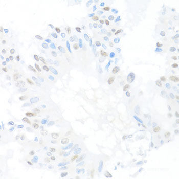 Immunohistochemistry of paraffin-embedded Mouse lung using CXXC1 Polyclonal Antibody at dilution of 1:200 (40x lens).