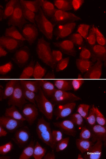 Immunohistochemistry of paraffin-embedded Rat kidney using DDX20 Polyclonal Antibody at dilution of 1:100 (40x lens).