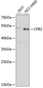 Immunofluorescence analysis of U2OS cells using KDM4B Polyclonal Antibody